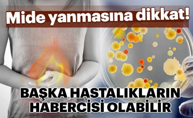 MİDE YANMASINA SEBEP