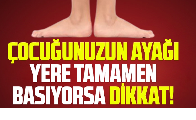 ÇOCUĞUNUZUN AYAĞI YERE TAMAMEN BASIYORSA DİKKAT !