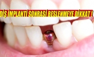 DİŞ İMPLANTI SONRASI BESLENMEYE DİKKAT !